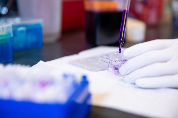 A photograph of a scientist's hands, in gloves, performing an experiment at a laboratory bench